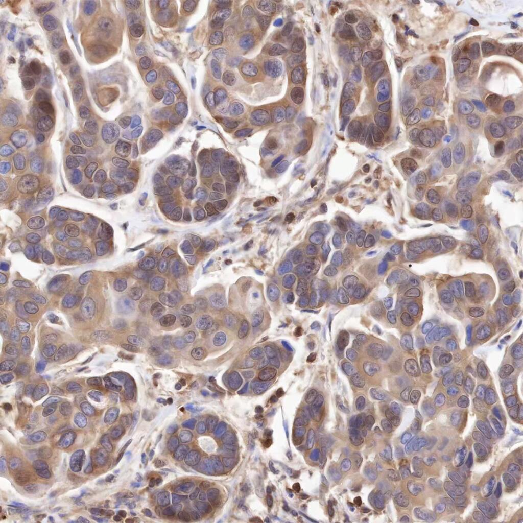 Anti-PDCD4 Mouse Monoclonal Antibody