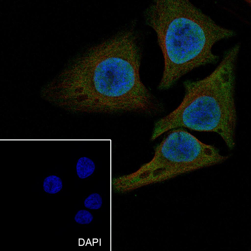 Anti-PDCD4 Mouse Monoclonal Antibody