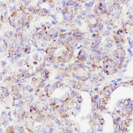 Anti-DIO2 Mouse Monoclonal Antibody