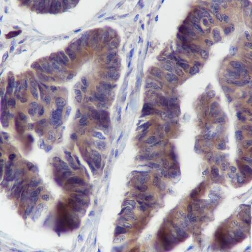 Anti-BCLG Mouse Monoclonal Antibody