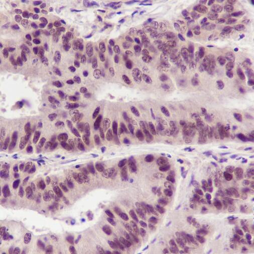 Anti-BRD8 Mouse Monoclonal Antibody