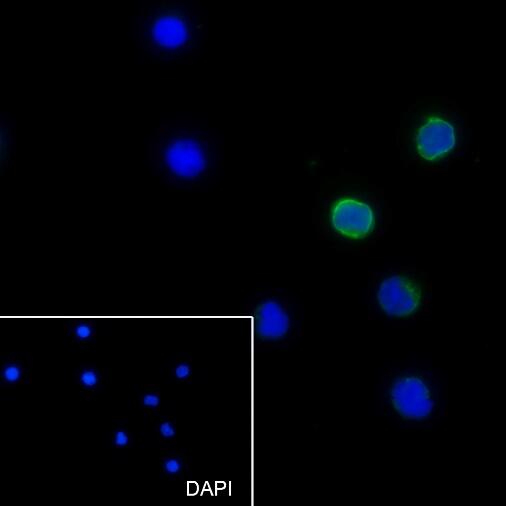 Anti-CD5 Mouse Monoclonal Antibody