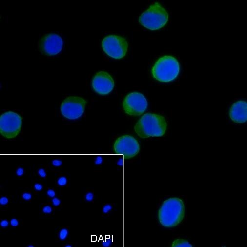 Anti-CD11a Mouse Monoclonal Antibody