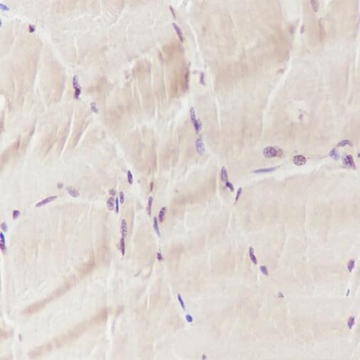 Anti-ANP32A Mouse Monoclonal Antibody