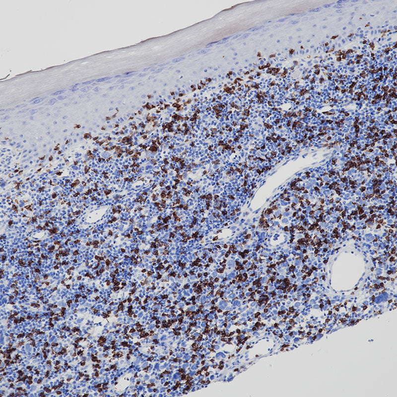 Anti-CD8 Rabbit Monoclonal Antibody