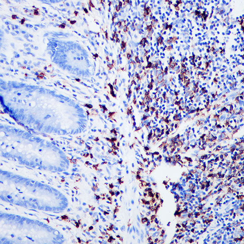 Anti-CD20 Rabbit Monoclonal Antibody