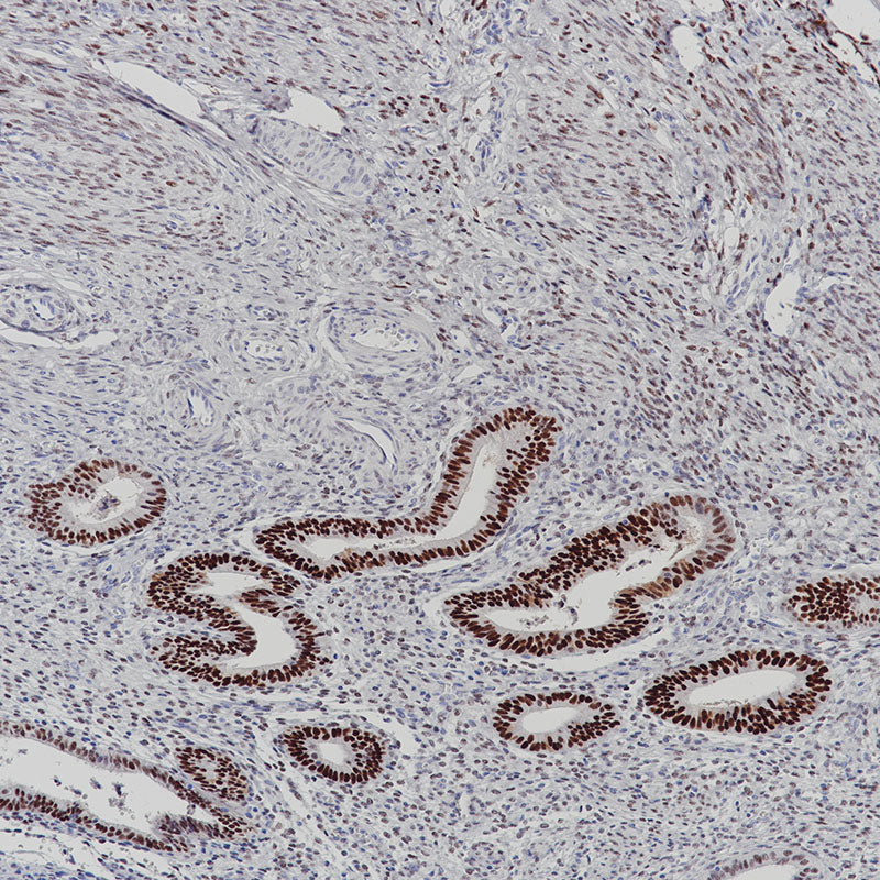 Anti-Estrogen Receptor alpha Rabbit Monoclonal Antibody