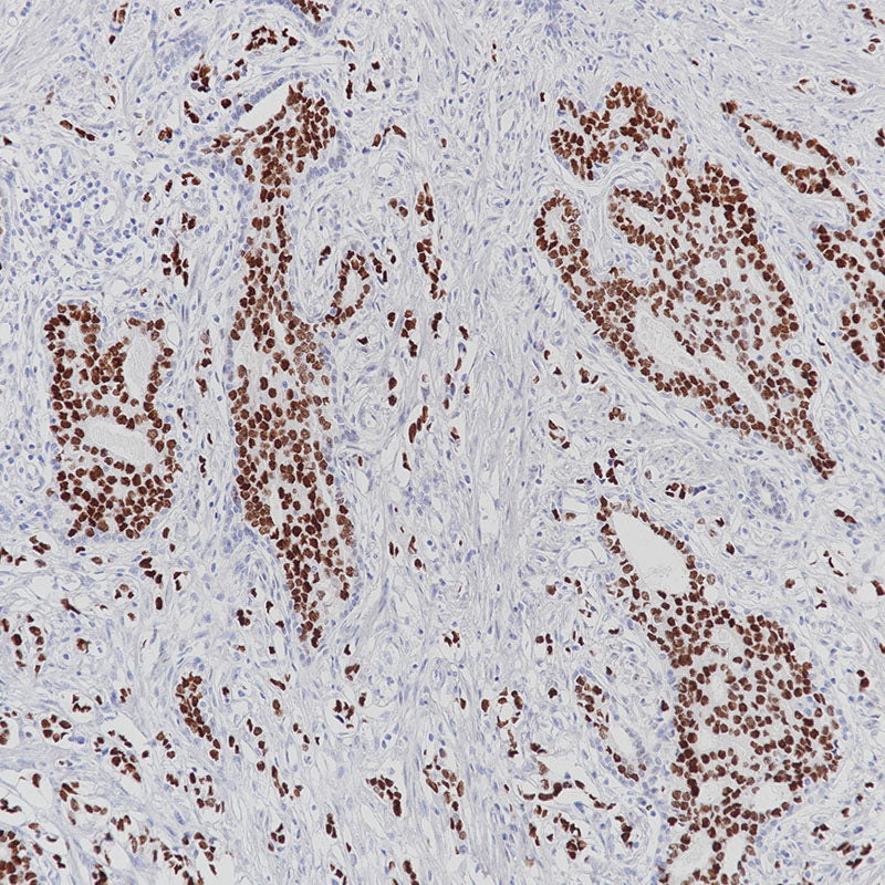 Anti-Androgen Receptor Rabbit Monoclonal Antibody