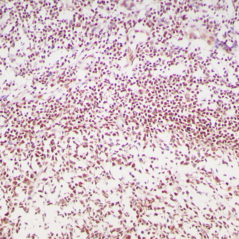 Anti-MGMT Rabbit Monoclonal Antibody