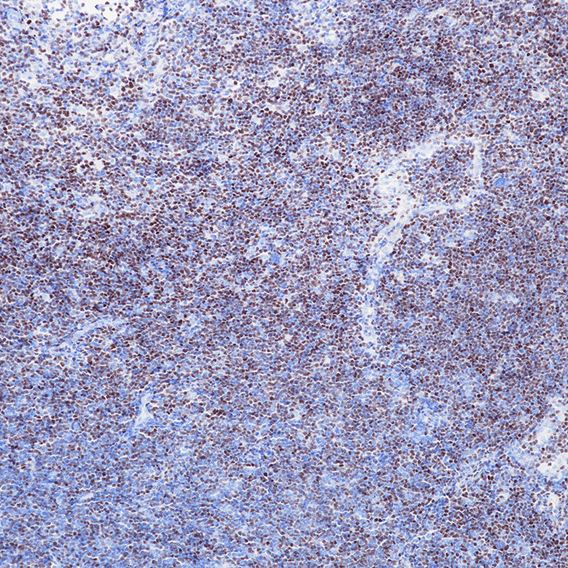Anti-SOX11 Rabbit Monoclonal Antibody