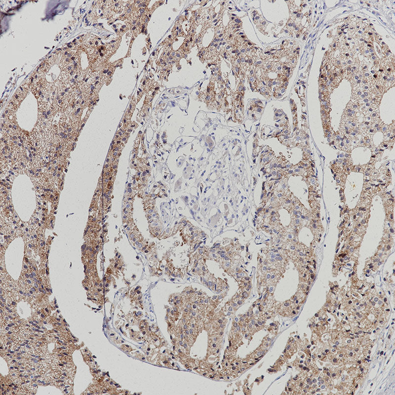 Anti-AMACR Rabbit Monoclonal Antibody