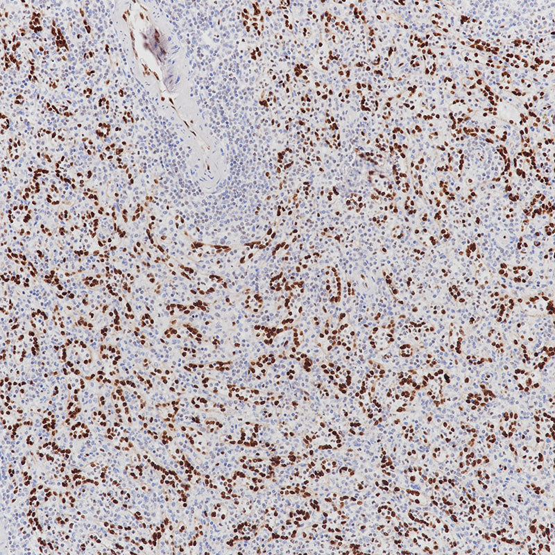 Anti-ERG Rabbit Monoclonal Antibody