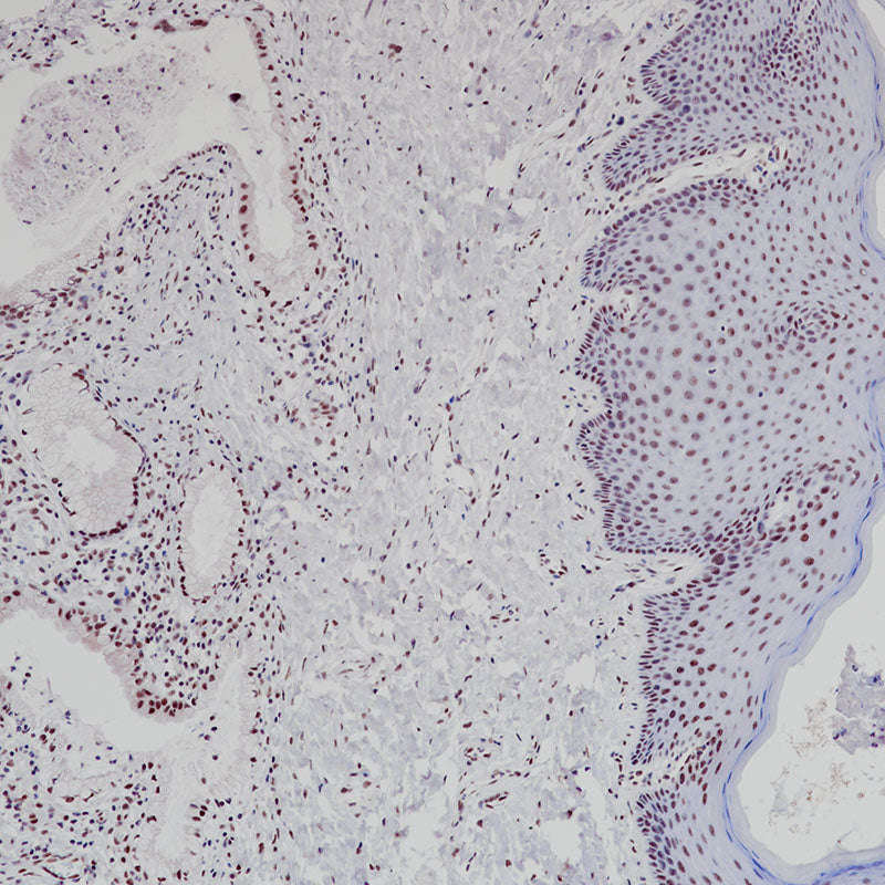 Anti-ATRX Rabbit Monoclonal Antibody