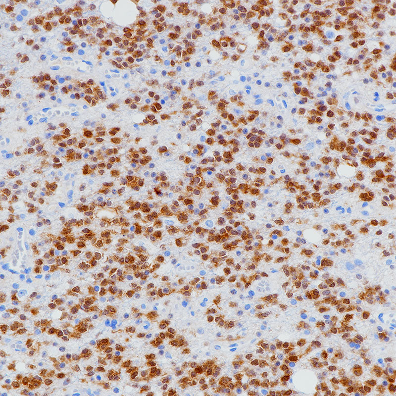 Anti-IDH1 Rabbit Monoclonal Antibody