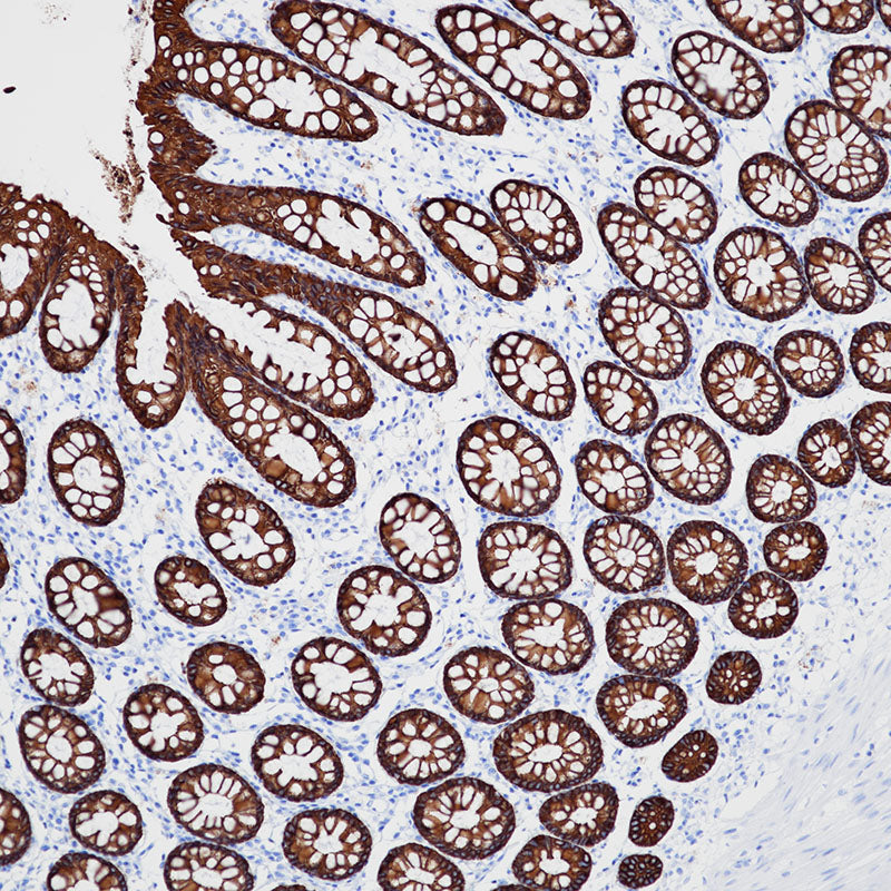 Anti-Cytokeratin 8 Rabbit Monoclonal Antibody