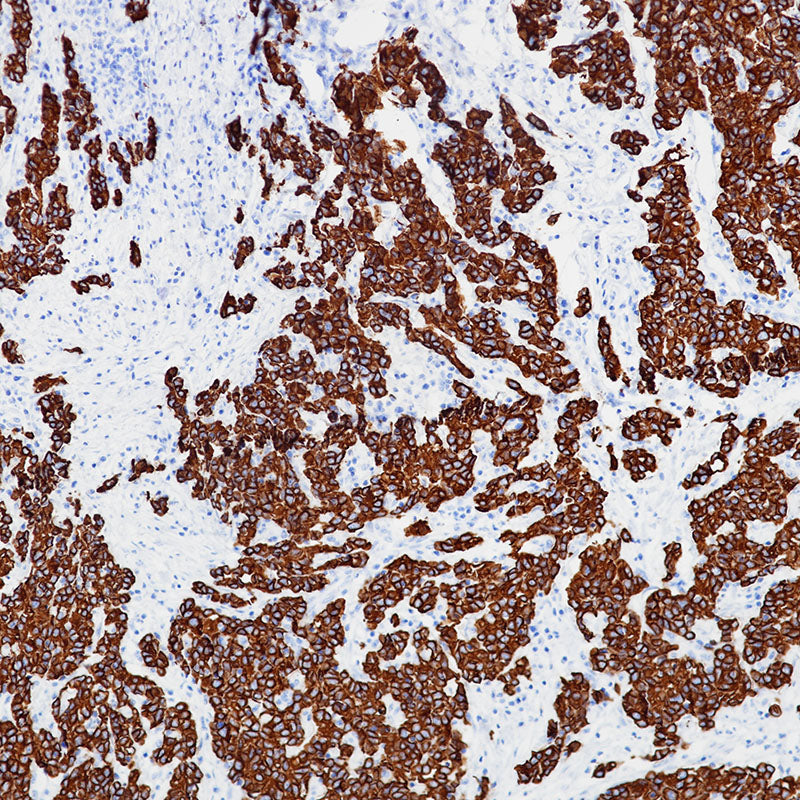 Anti-Cytokeratin 8 Rabbit Monoclonal Antibody