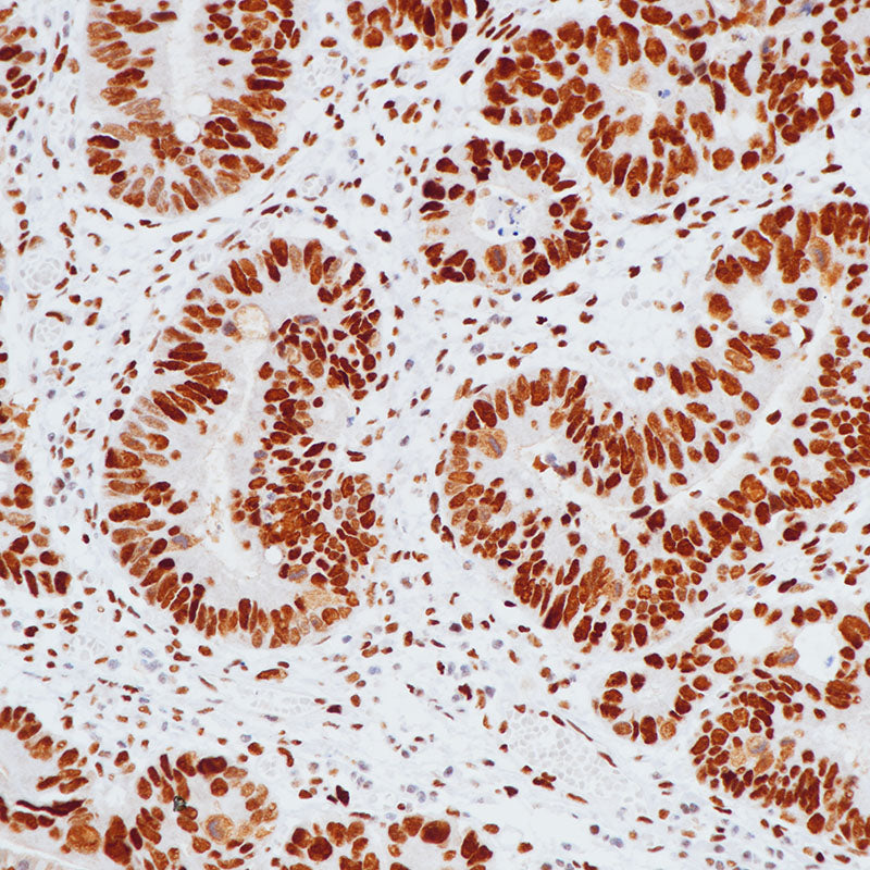 Anti-MSH6 Rabbit Monoclonal Antibody