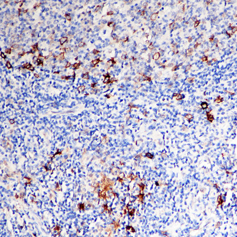 Anti-CD30 Rabbit Monoclonal Antibody