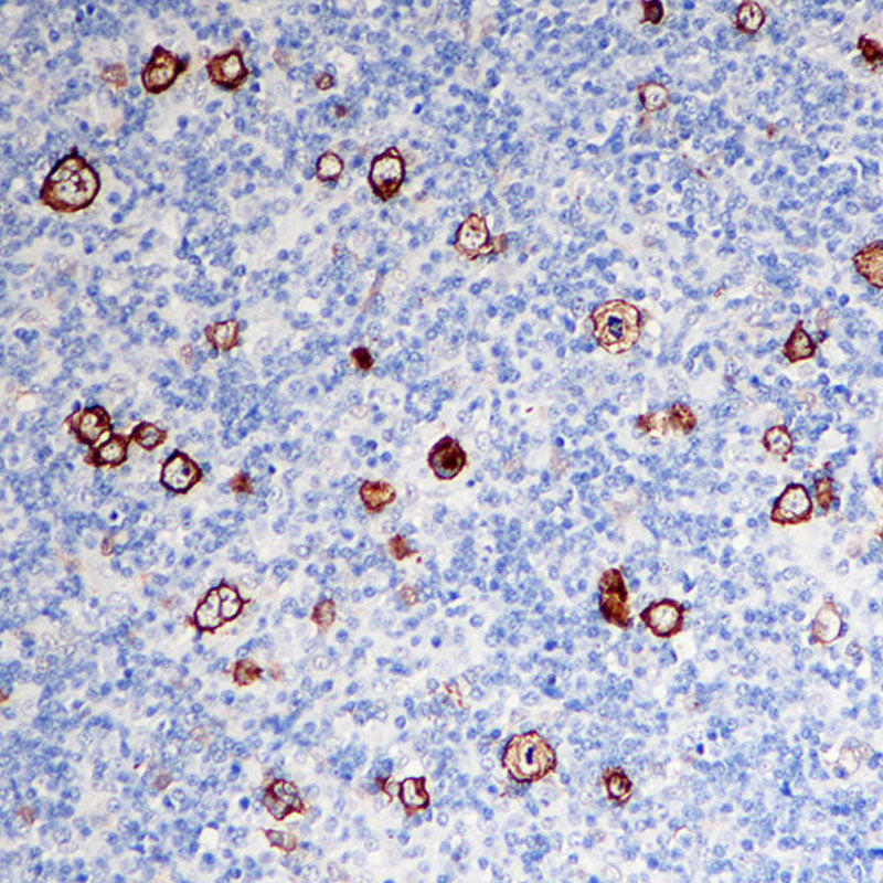 Anti-CD30 Rabbit Monoclonal Antibody