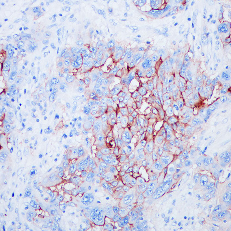Anti-Mucin 16 Rabbit Monoclonal Antibody
