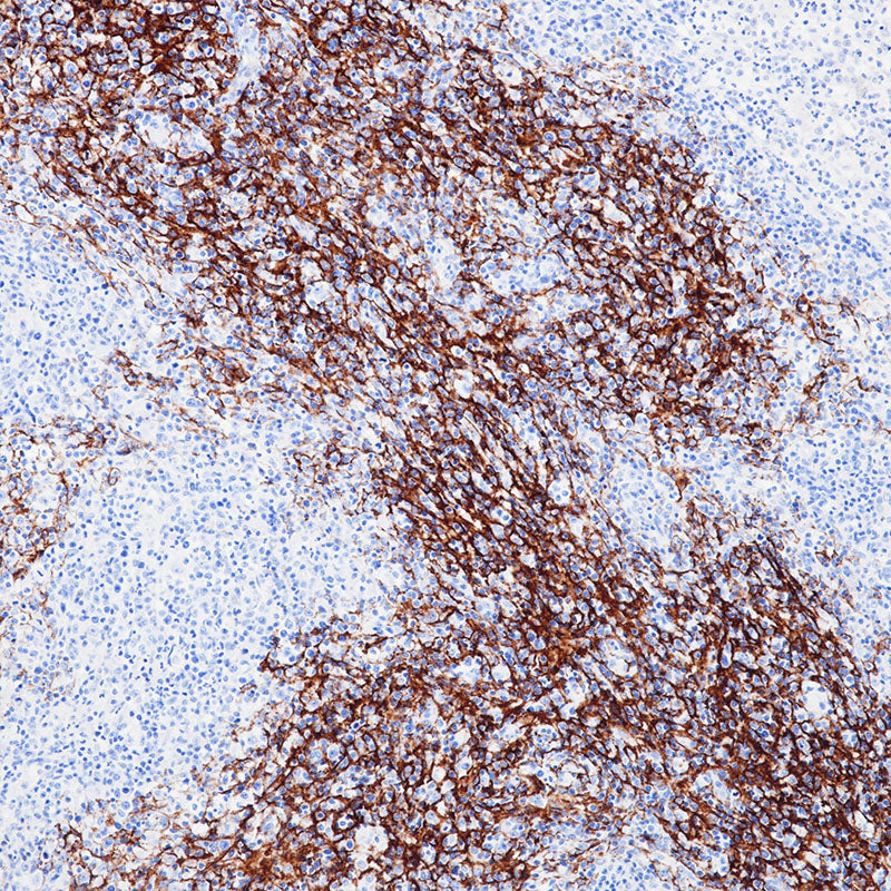 Anti-CD21 Rabbit Monoclonal Antibody