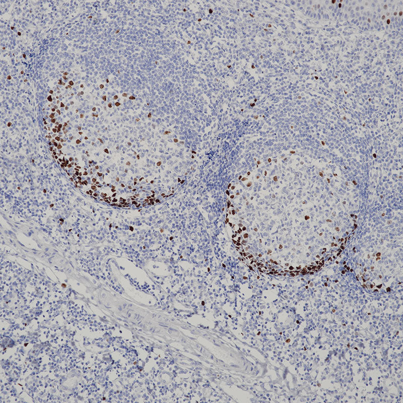 Anti-Topoisomerase II alpha Rabbit Monoclonal Antibody