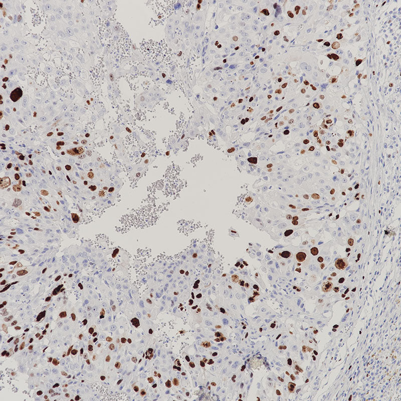 Anti-Topoisomerase II alpha Rabbit Monoclonal Antibody