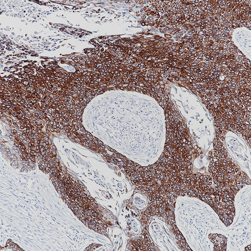 Anti-Cytokeratin 5 Rabbit Monoclonal Antibody
