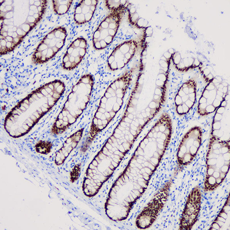 Anti-CDX2 Rabbit Monoclonal Antibody