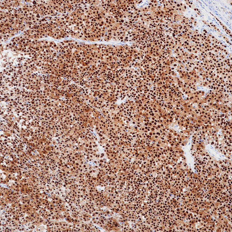 Anti-SOX10 Rabbit Monoclonal Antibody