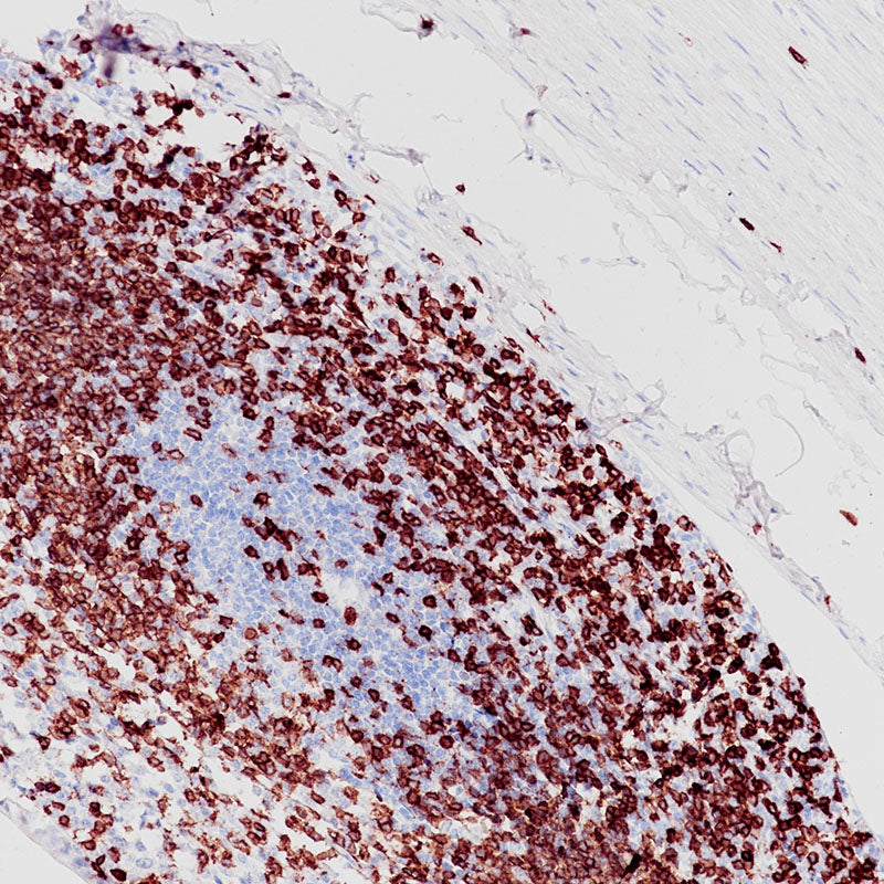 Anti-CD3e Rabbit Monoclonal Antibody