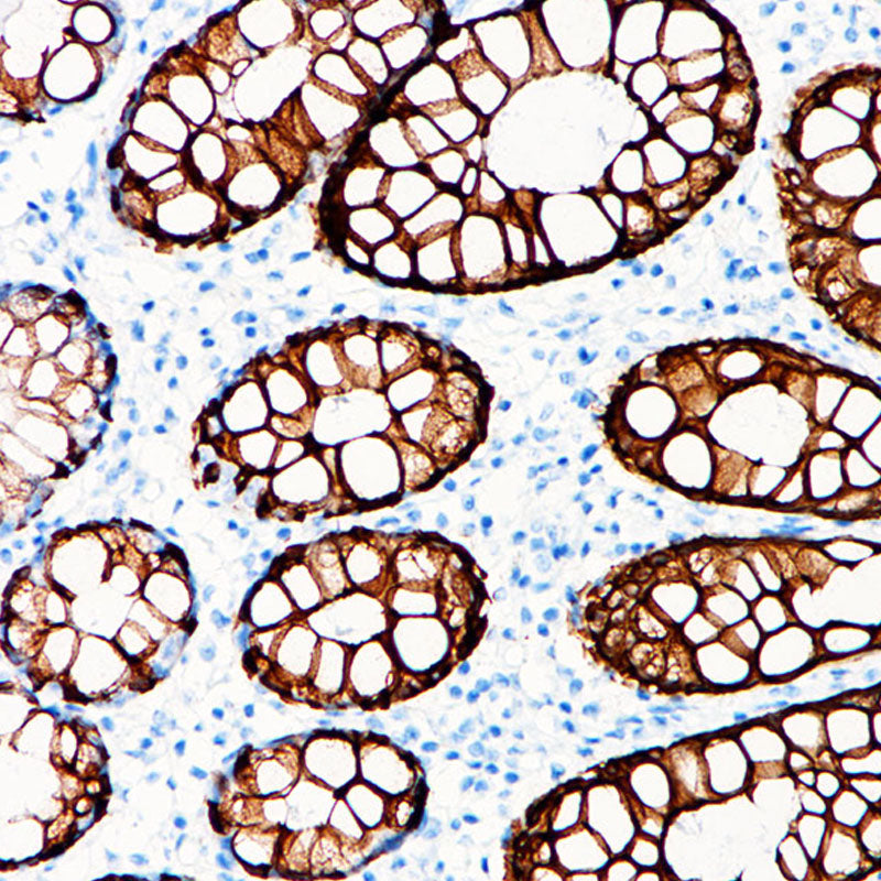 Anti-Cytokeratin 20 Rabbit Monoclonal Antibody