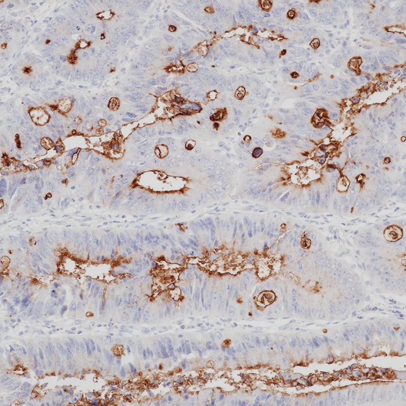 Anti-Mucin 1 Rabbit Monoclonal Antibody