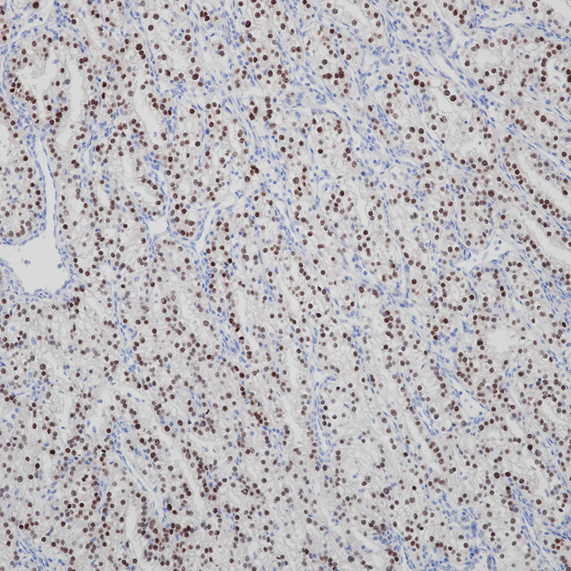 Anti-PAX2 Rabbit Monoclonal Antibody