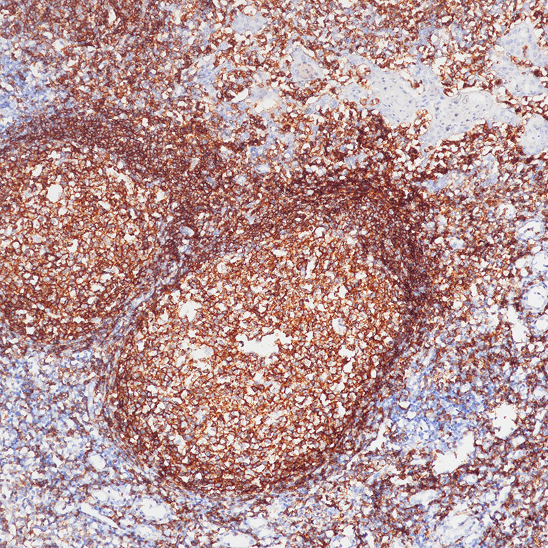Anti-CD19 Rabbit Monoclonal Antibody