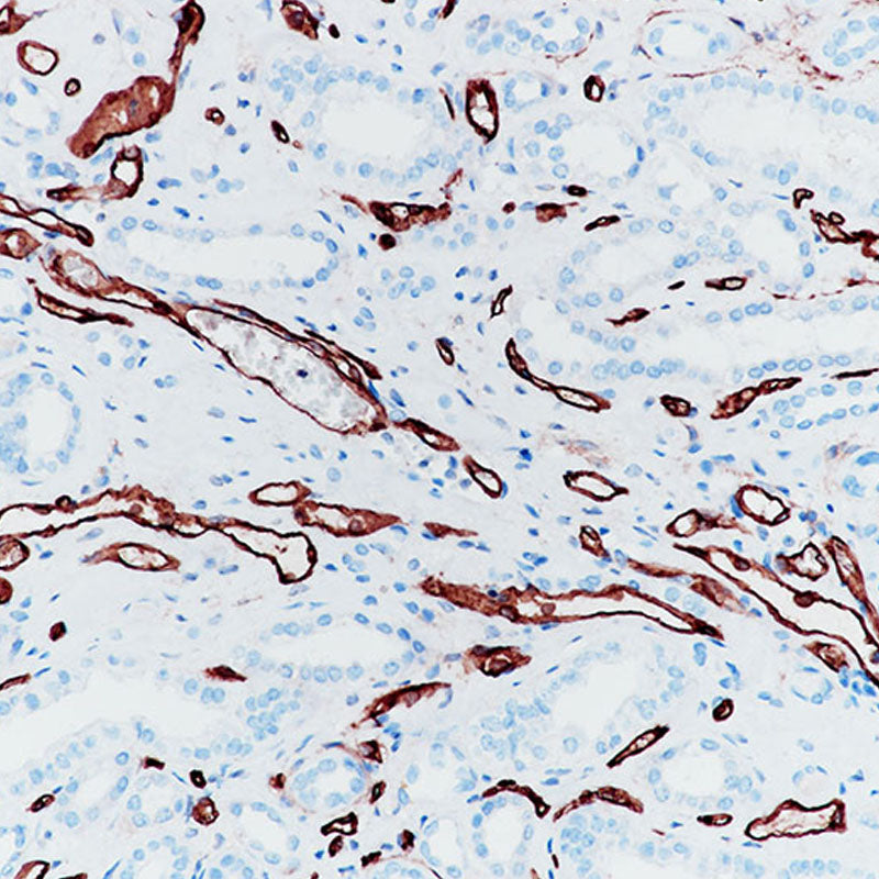 Anti-CD34 Rabbit Monoclonal Antibody