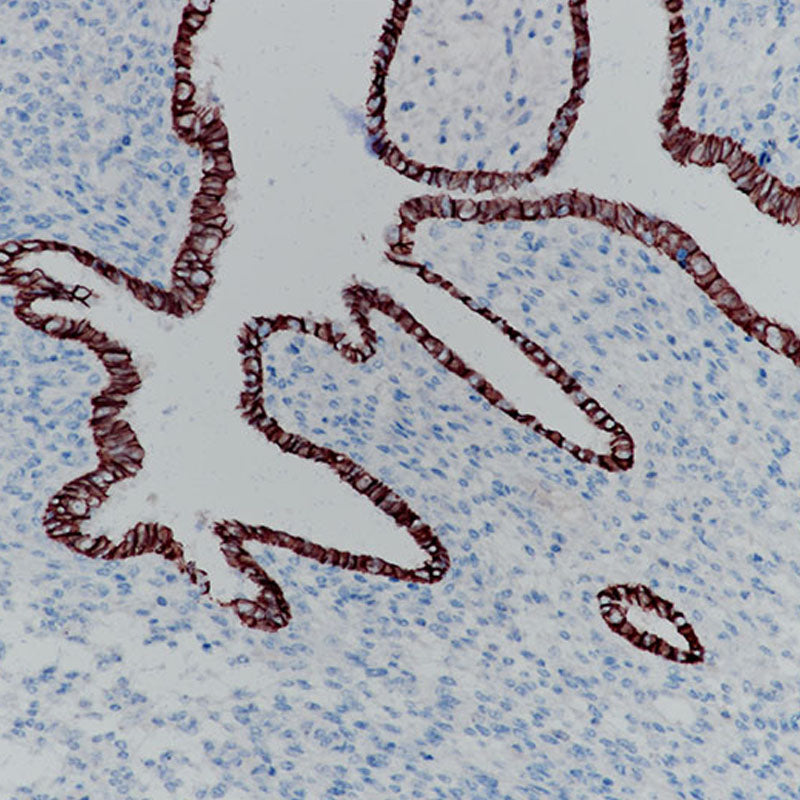 Anti-E Cadherin Rabbit Monoclonal Antibody