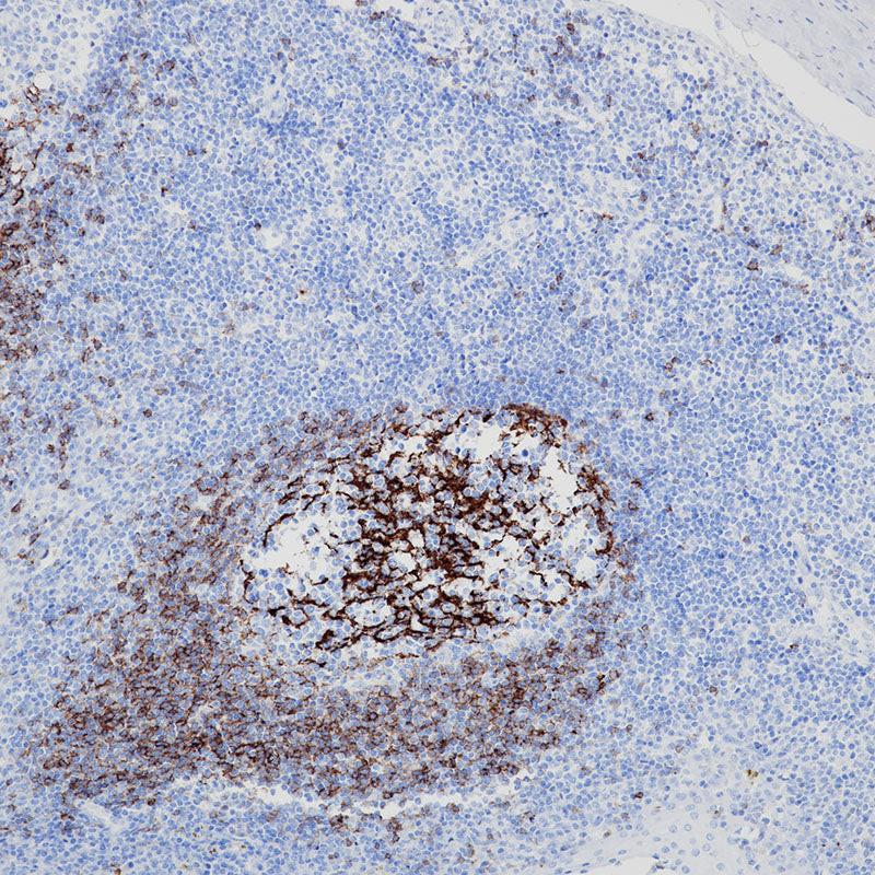 Anti-CD23 Rabbit Monoclonal Antibody