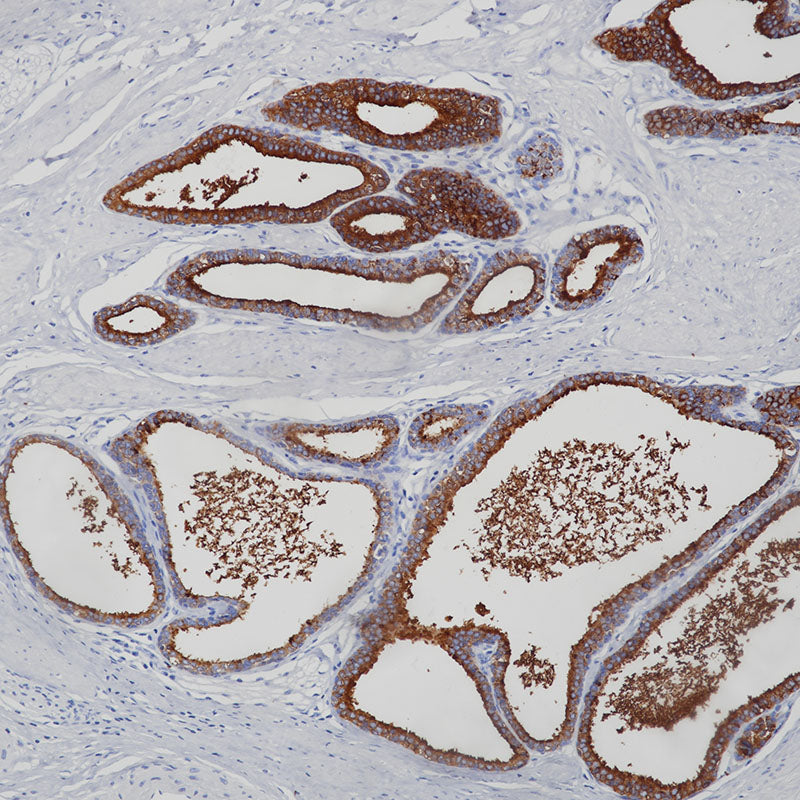 Anti-Prostatic Acid Phosphatase Rabbit Monoclonal Antibody