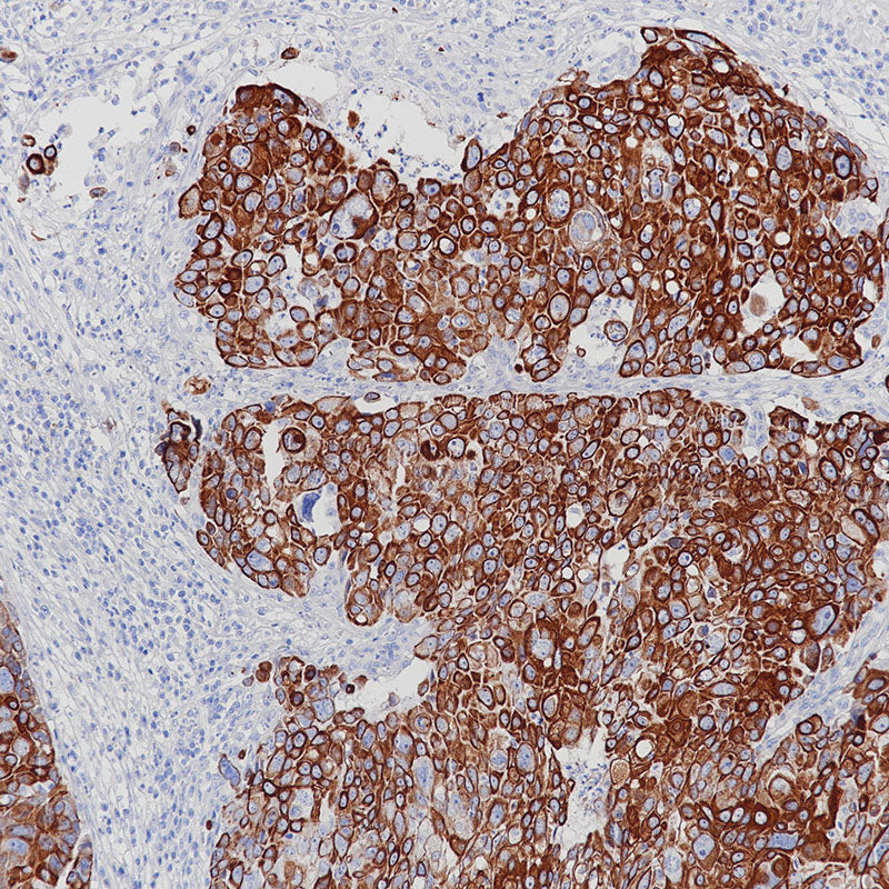 Anti-Cytokeratin Type I Rabbit Monoclonal Antibody