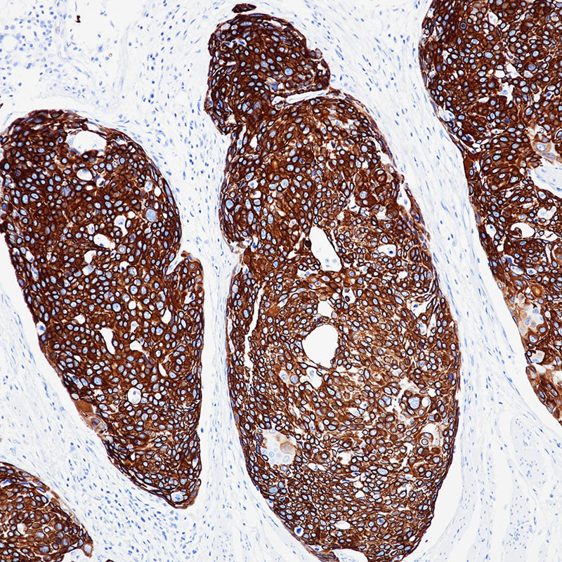 Anti-Cytokeratin 14 Rabbit Monoclonal Antibody