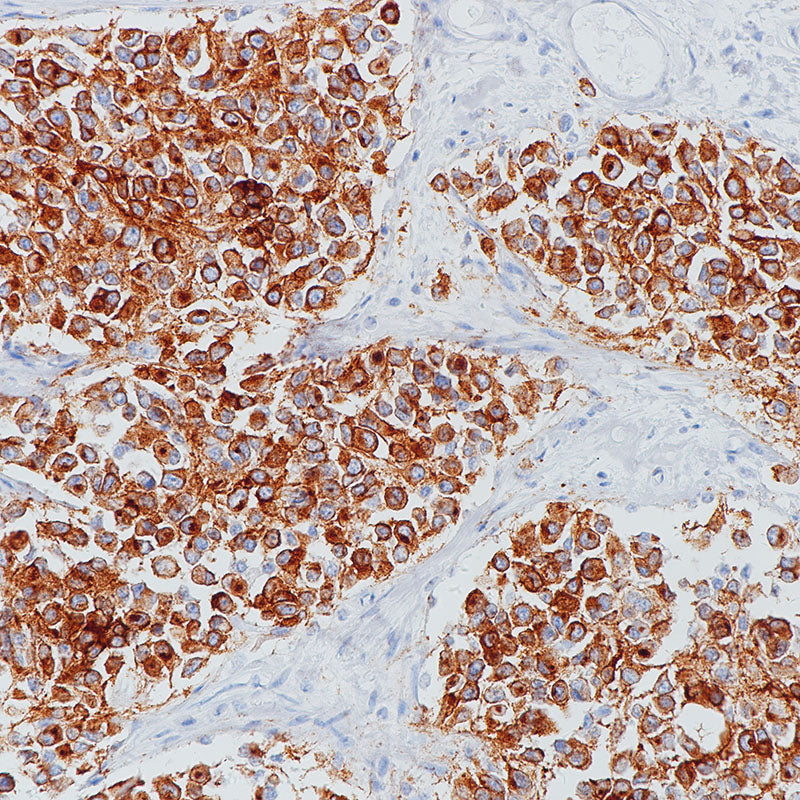 Anti-Synaptophysin Rabbit Monoclonal Antibody