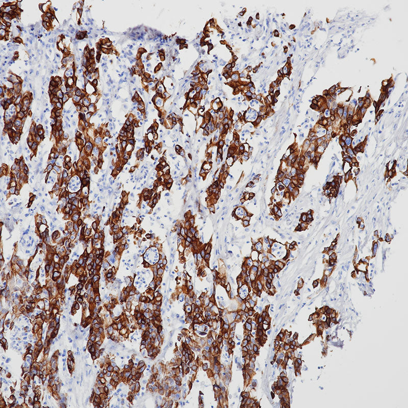 Anti-Cytokeratin 18 Rabbit Monoclonal Antibody