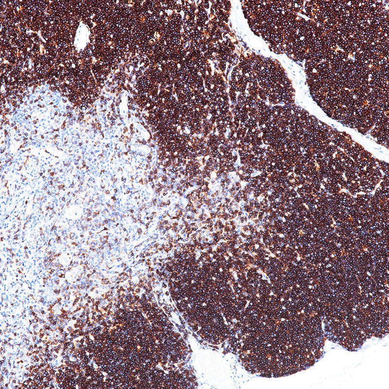 Anti-CD1a Rabbit Monoclonal Antibody