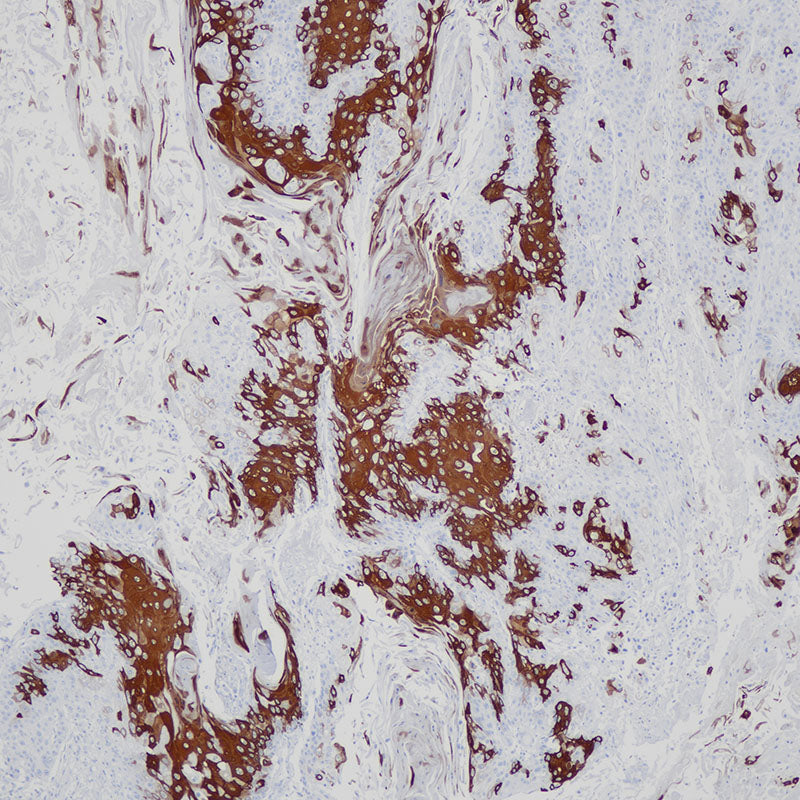 Anti-Cytokeratin 10 Rabbit Monoclonal Antibody