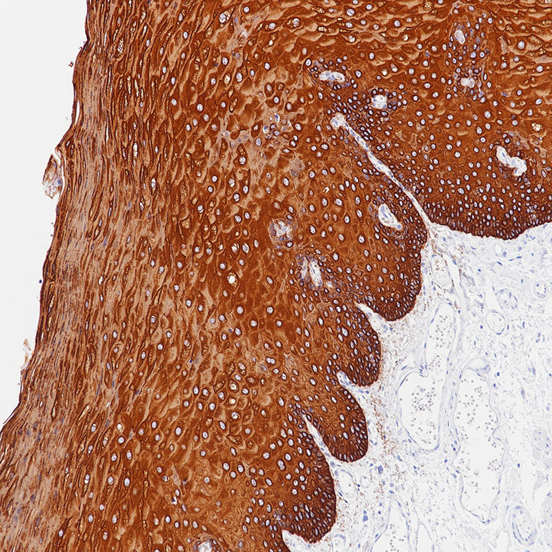 Anti-Cytokeratin Type II Rabbit Monoclonal Antibody