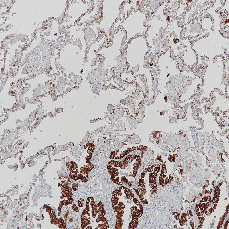 Anti-Cytokeratin 7 Rabbit Monoclonal Antibody