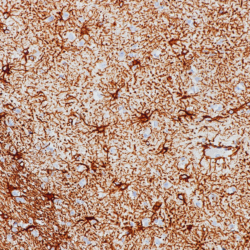 Anti-GFAP Rabbit Monoclonal Antibody