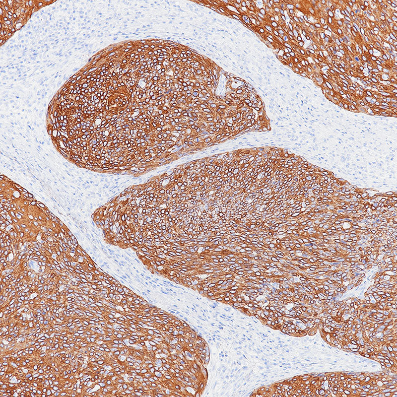 Anti-Cytokeratin 6 Rabbit Monoclonal Antibody