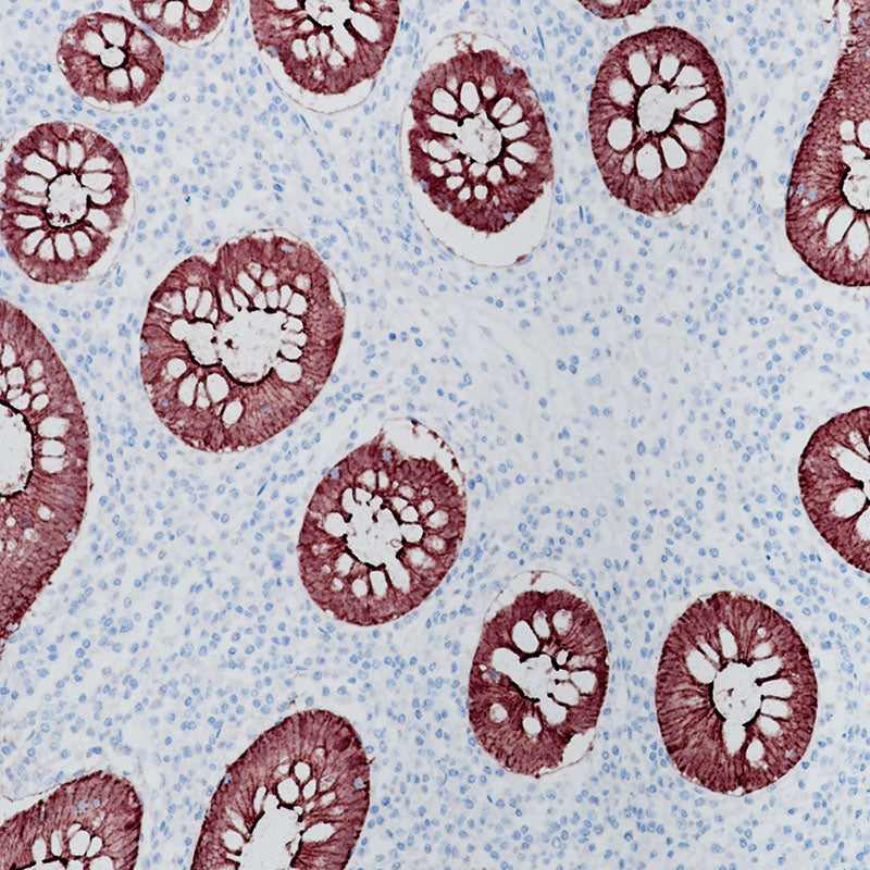 Anti-Villin Rabbit Monoclonal Antibody